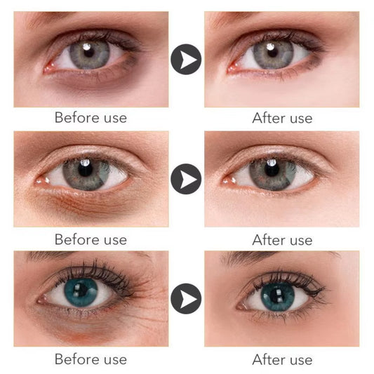 Retinol Anti-Aging Whitening Oil Control Eye Serum Gold Serum Korean Skin Care Products