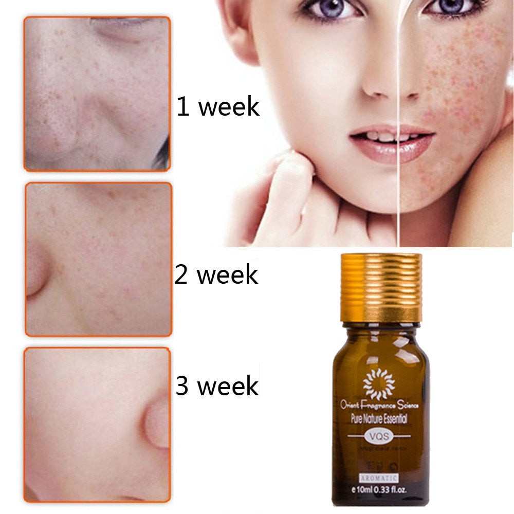 Dredge Meridian Skin Care زيت إزالة الندبات وعلامات التمدد وحب الشباب الطبيعي النقي